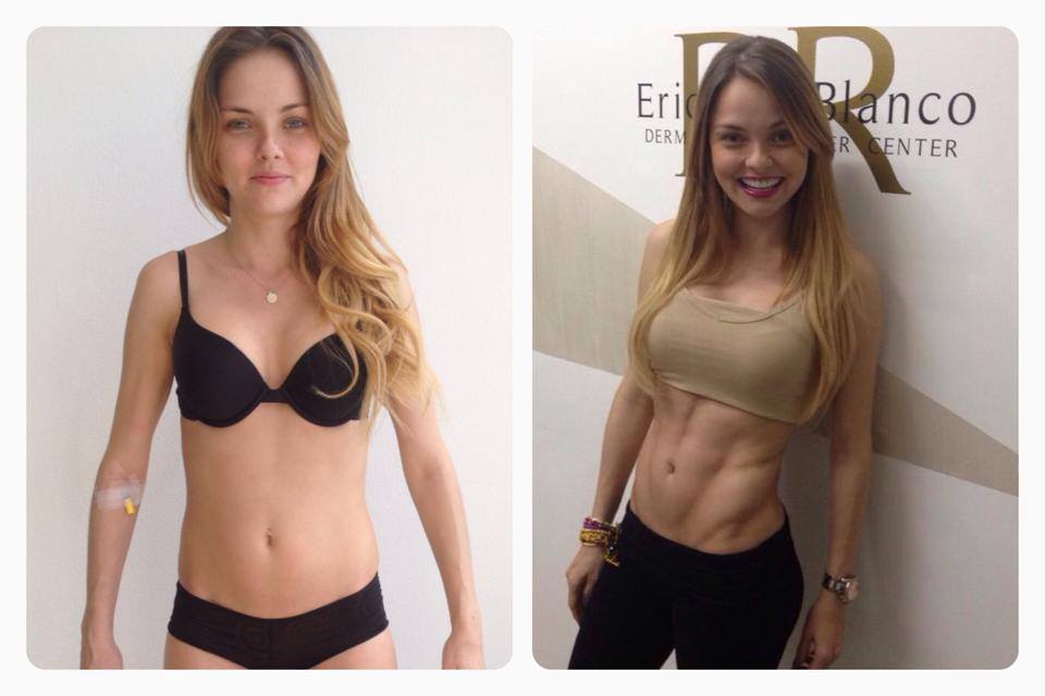 Mariluz Bermúdez muestra su Slim láser