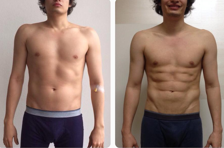 Slim Láser logra cambiar tu abdomen