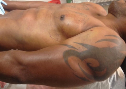 Realizamos la marcación de brazos, pecho y abdomen de un conocido. Adivinen quien es…