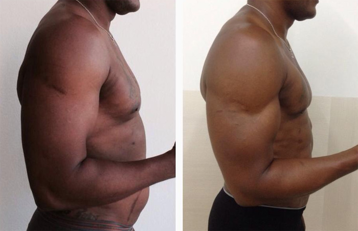 Formar tu brazo ya es posible con nosotros