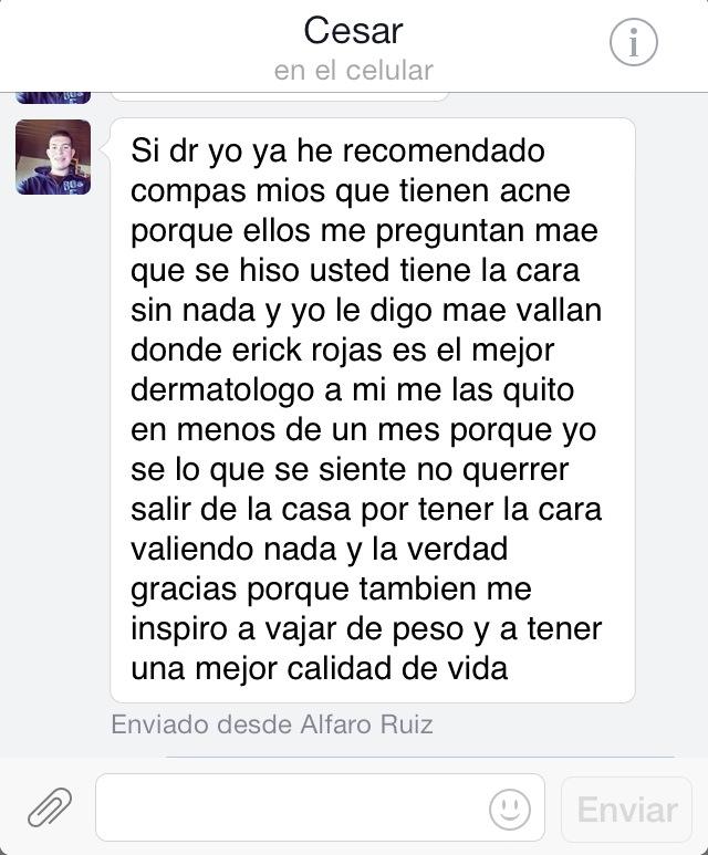 Cesar gracias por tu comentario…