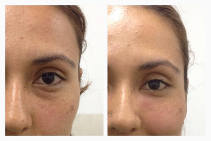Disminuir tus ojeras va hacer que te veas más fresca
