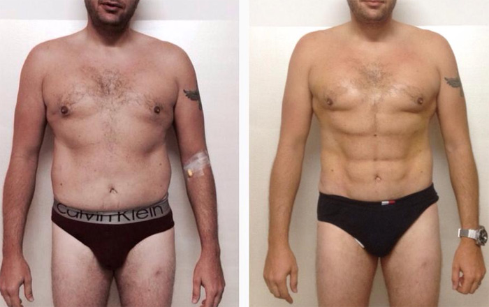 A 22 días de Slim Laser