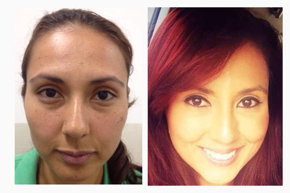 Elimine sus ojeras de una forma simple y rápida