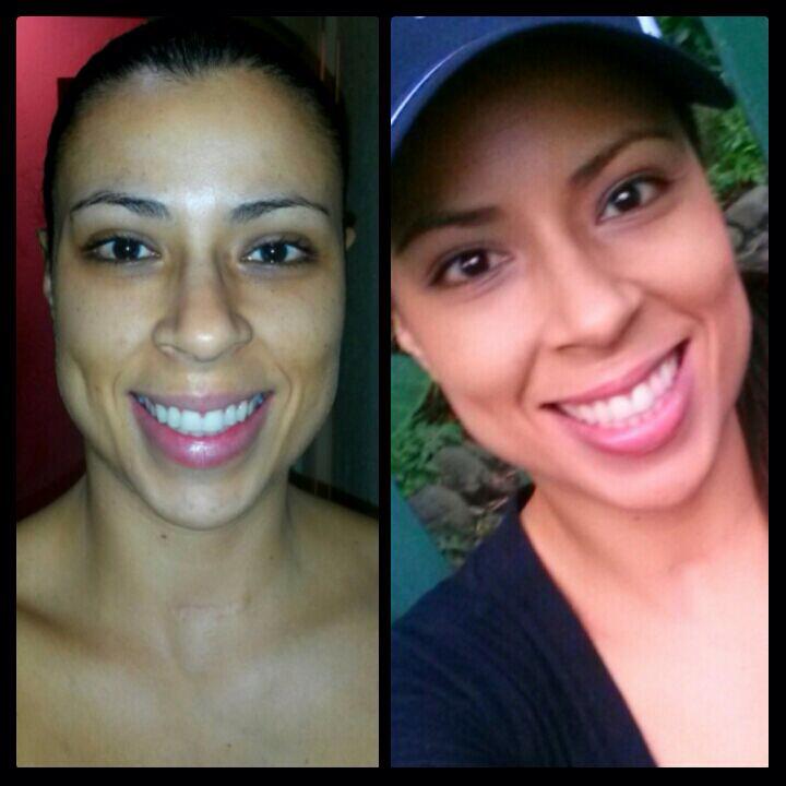 Luce un cutis fresco y radiante con nuestros tratamientos