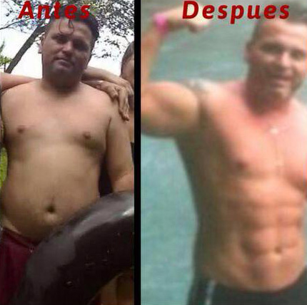 Feliz cuando nuestros pacientes nos permiten mostrar lo que hacemos