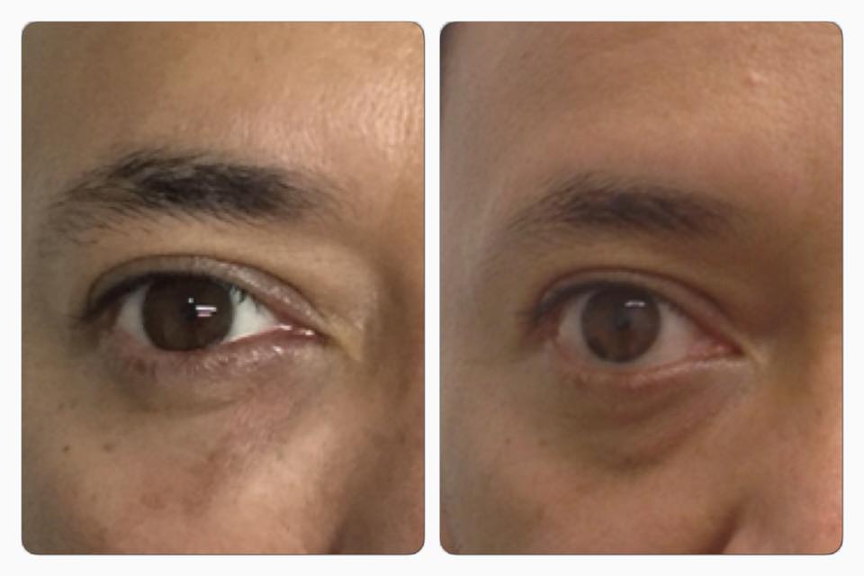 Minimiza tus ojeras en segundos.