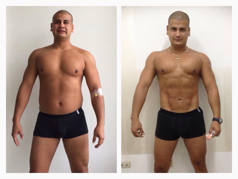 ﻿Un día después de Slim Láser Daniel muestra muy feliz
