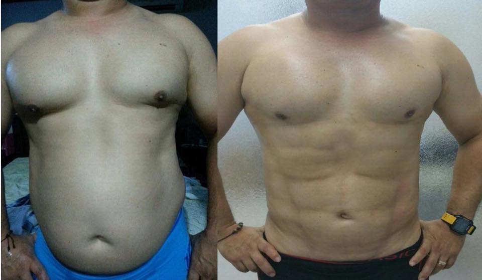 A 17 días de (SLIM Dr. E ) nuestro amigo y paciente nos muestra su increíble resultado