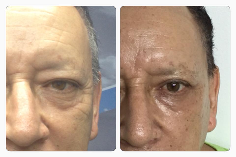 Refrescar tus ojos y tu rostro es posible con nosotros.