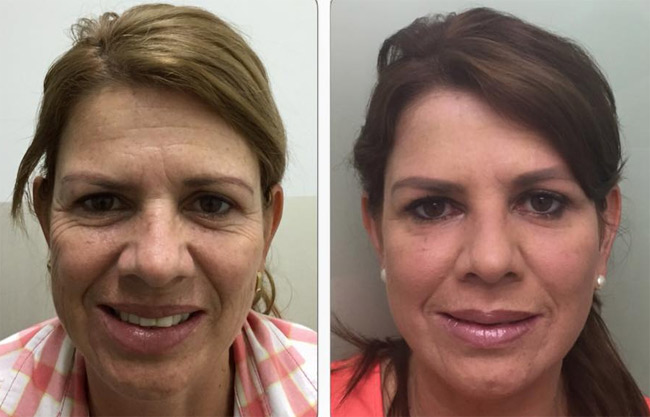 TU ROSTRO, puedes verte cada año más joven