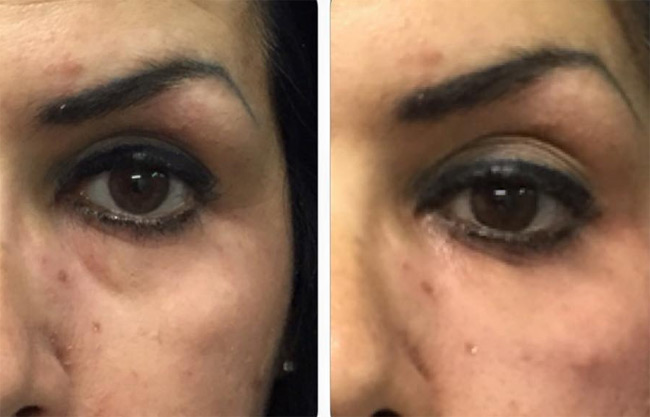 Tus OJERAS YA PUEDES MEJORARLAS de una forma simple y EFECTIVA
