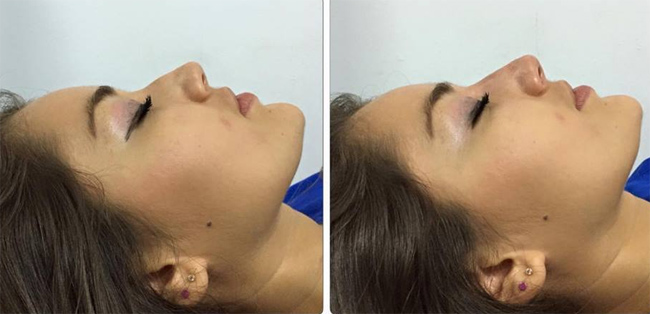 Tu Perfil Perfecto en solo minutos.