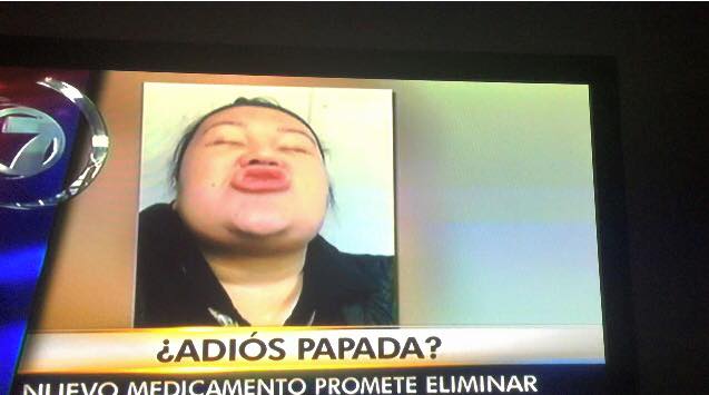 Adiós a la PAPADA EN TELENOTICIAS 7