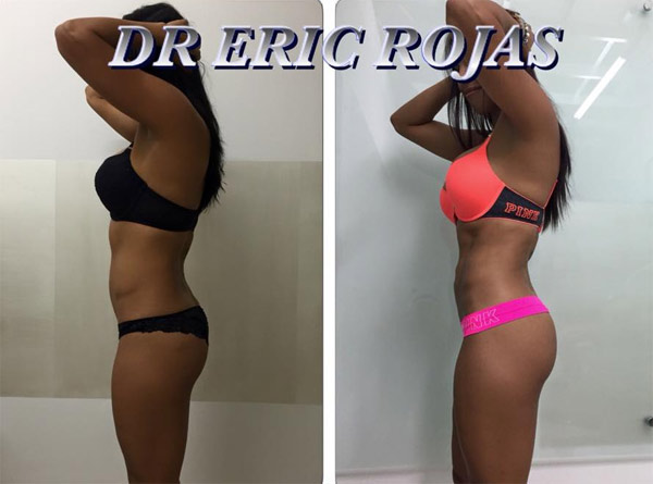 NUESTROS TRATAMIENTO SLIM LASER ESTILIZAN TU FIGURA Y TE HACEN VER INCREÍBLE.