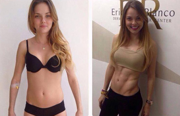 MARILUZ BERMUDEZ ACTRIZ COSTARRICENSE EXITOSA EN MÉXICO NOS MUESTRA SU ABDOMEN SLIM LASER
