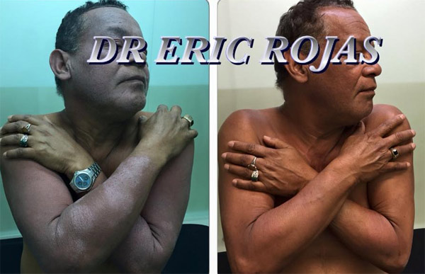 EN UNA SEMANA GRACIAS A DIOS logramos devolver la tranquilidad nuestro paciente