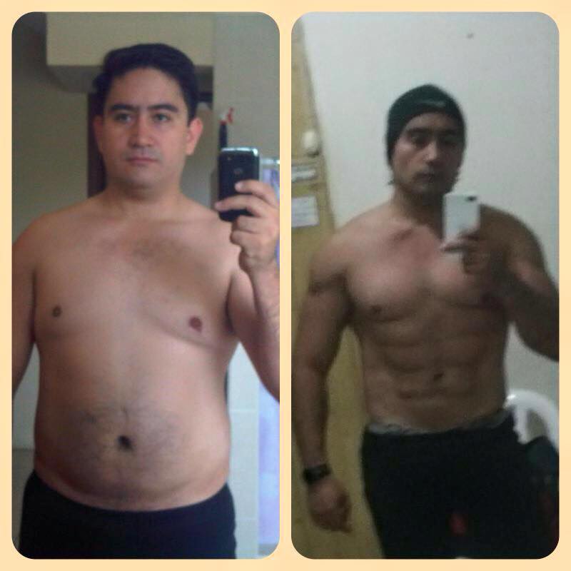 Abdomen SLIM LASER