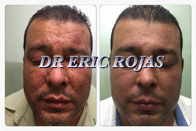 Mejoramos un rostro en menos de dos semanas