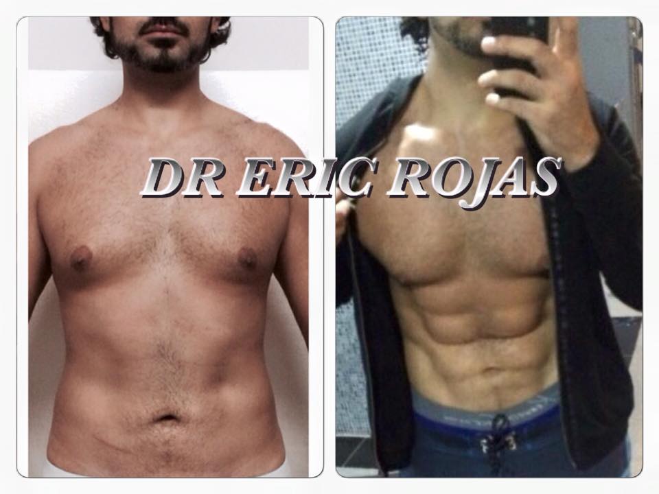 SLIM LASER simplemente un procedimiento DERMOCOSMETICO que cambia tu vida