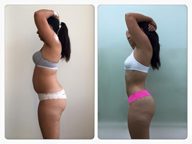 Logramos cambiar tu cuerpo
