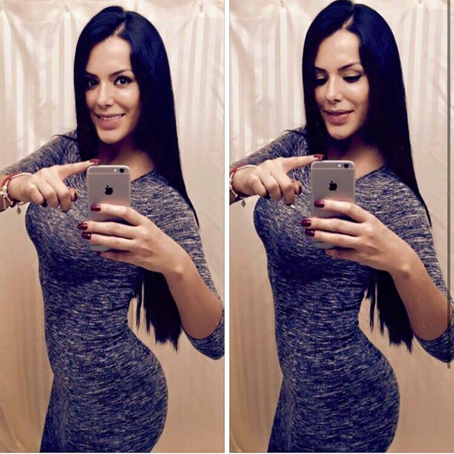 Qué bonito se siente cuando nuestras pacientes nos envían las fotos para que veamos las figuras tan bellas que lucen después del SLIM LASER