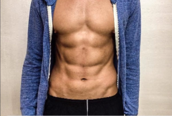 Slim Laser en hombres…