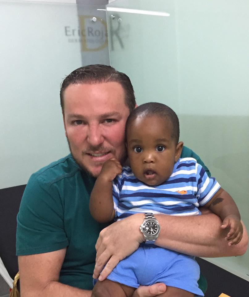 Vean la belleza de bebe Jaden Campos que me viene a visitar y tenemos su piel súper bien
