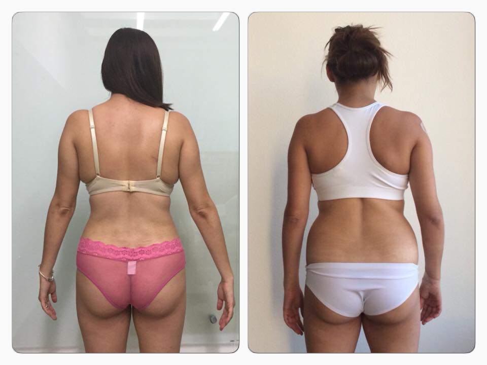 Cambios increíble solo con Slim LASER del Dr Eric Rojas. BUSCANOS somos lo que necesitas