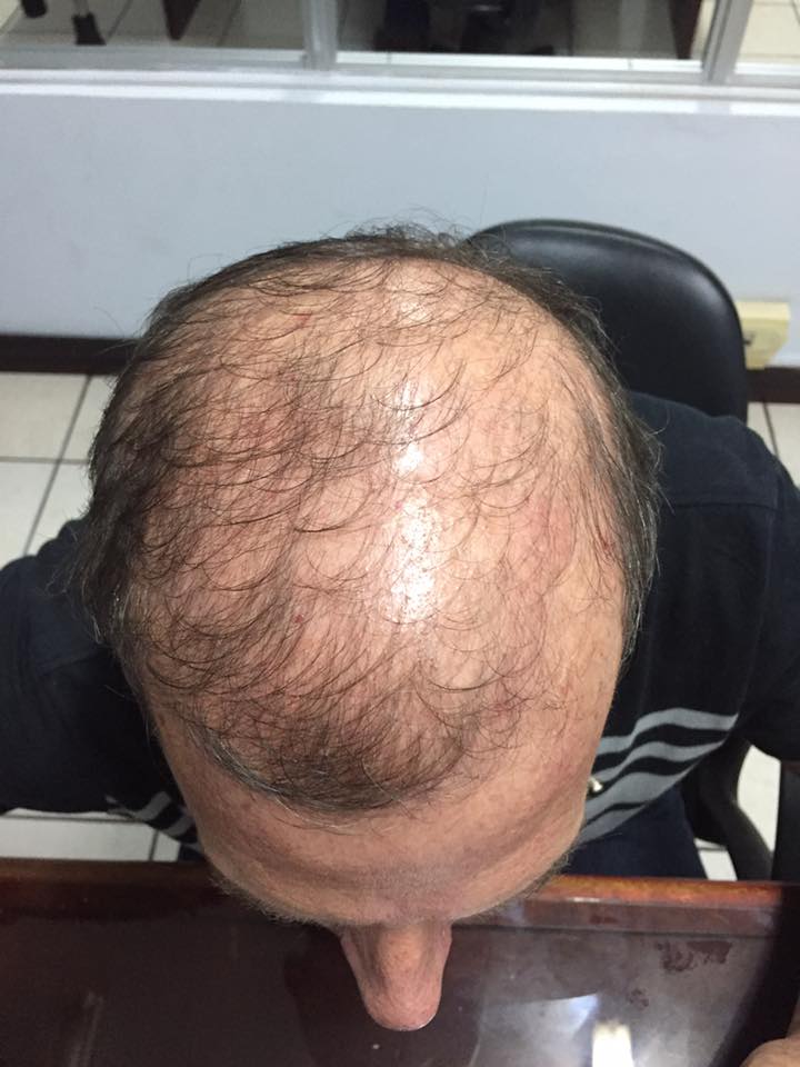 Mejora tu cabello acá te damos la solución. No te conformes con menos.