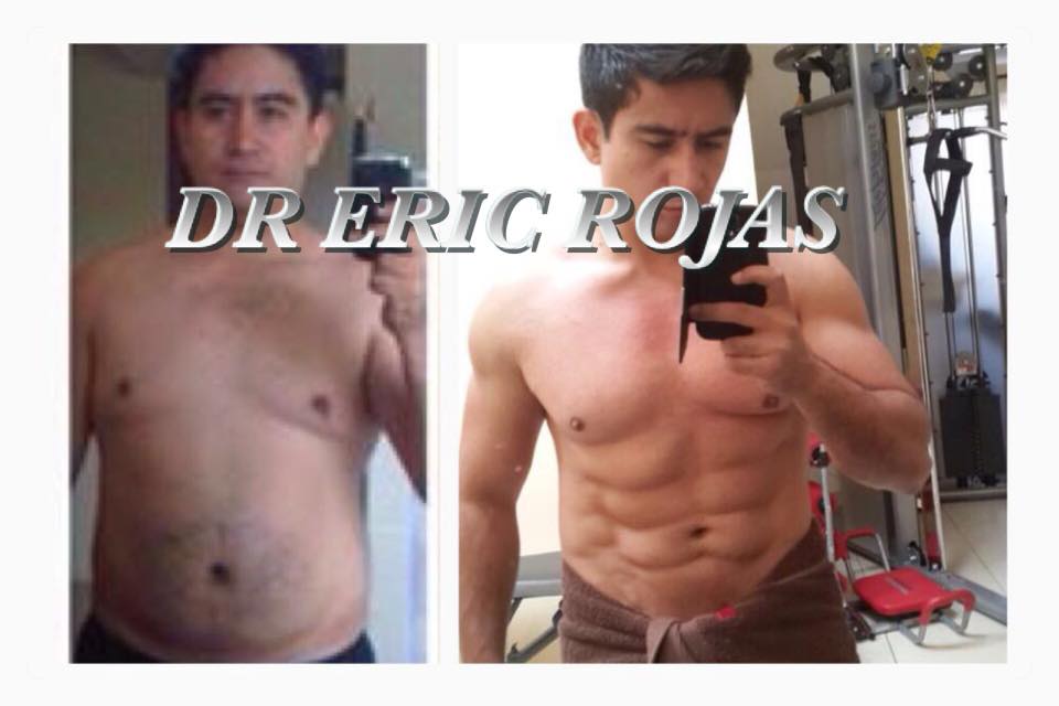 SLIM LASER ( NO es una liposucción ) …
