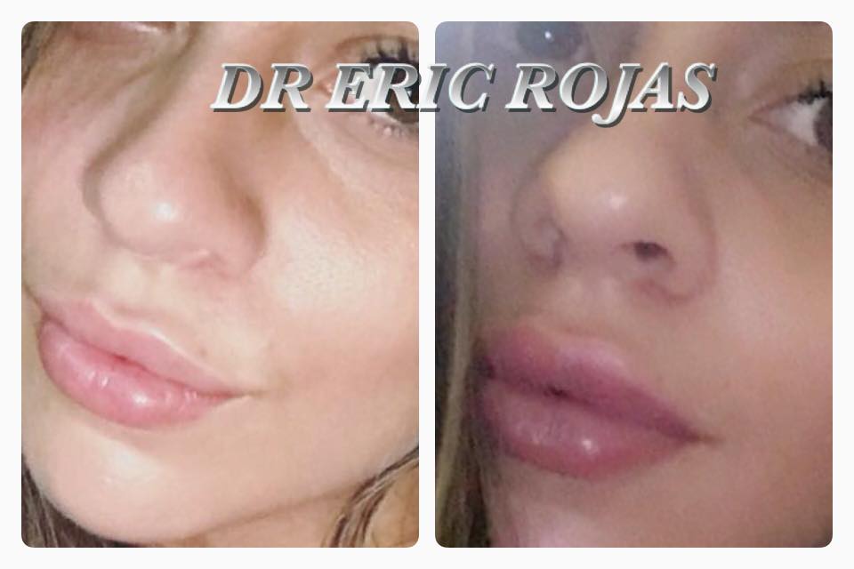 LABIOS MÁS ATRACTIVOS