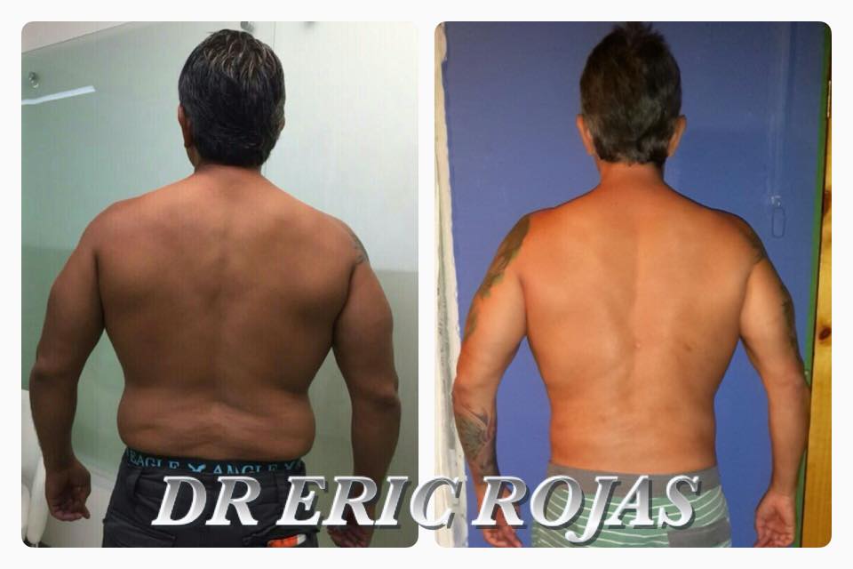 A SOLO 800 dólares