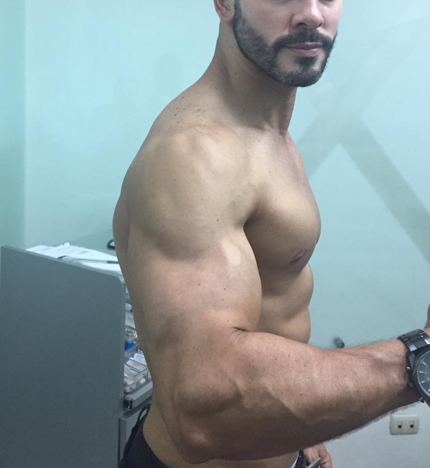La constancia y esfuerzo en el gimnasio más una pequeña ayuda dita con SLIM LASER LOGRA DEFINIR BIEN TU BRAZO