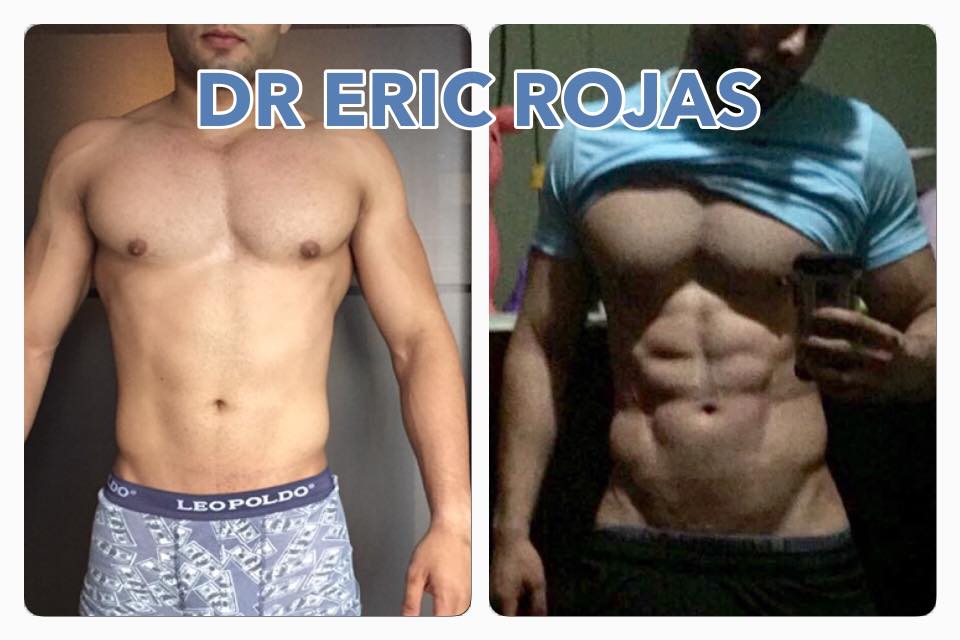 SLIM LASER DR ERIC ROJAS