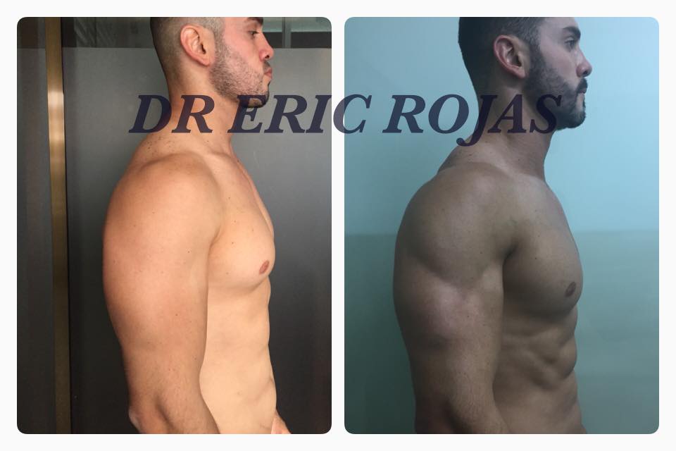 El GYM más SLIM LASER INCREMENTA TU ESFUERZO
