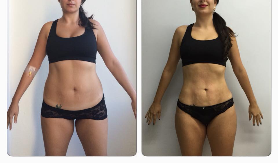 Slim LÁSER DR ERIC ROJAS CAMBIA TU CUERPO Y TU VIDA.