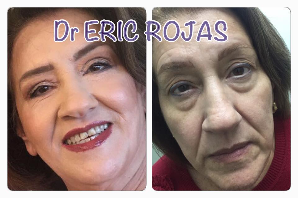 Nosotros hacemos que sonrías de verte mejor que hace muchos años