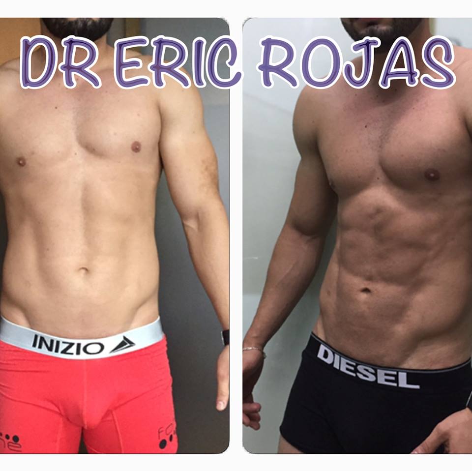 SLIM LÁSER ALTA DEFINICIÓN