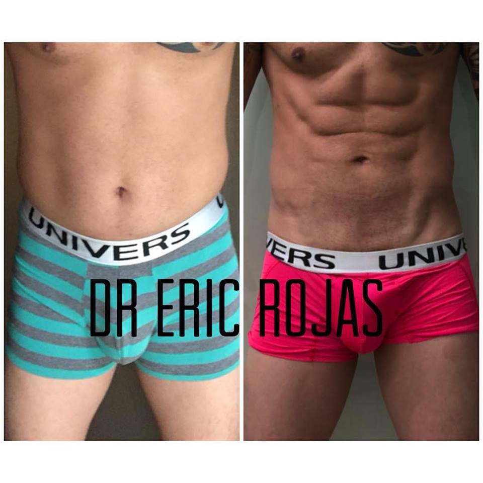 Un abdomen de lujo
