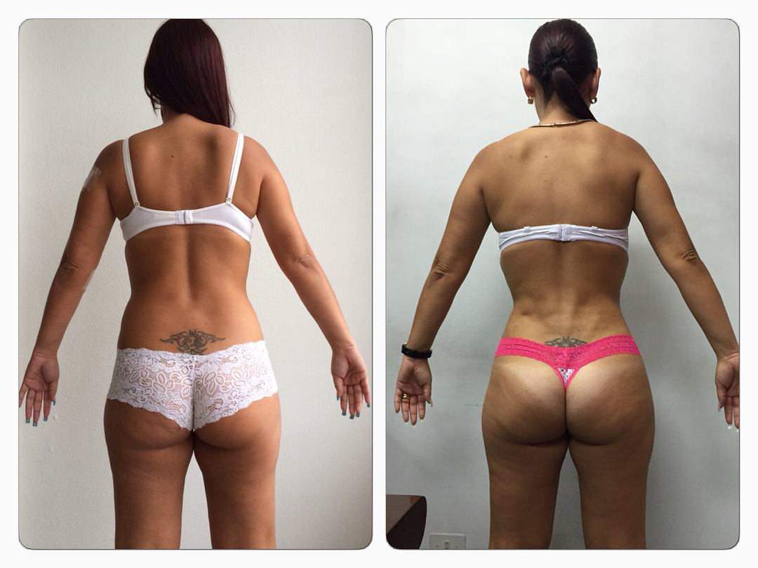 SLIM LÁSER DR ERIC ROJAS CAMBIA NO SOLO TU CUERPO SINO TU VIDA