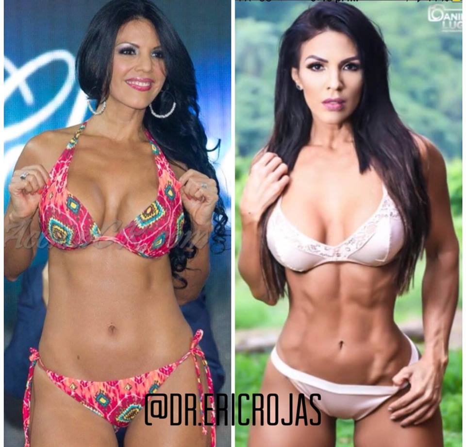 SLIM LÁSER DR ERIC ROJAS y ejercicio crea los mejores abdómenes que has visto es el complemento perfecto para lucir increíble