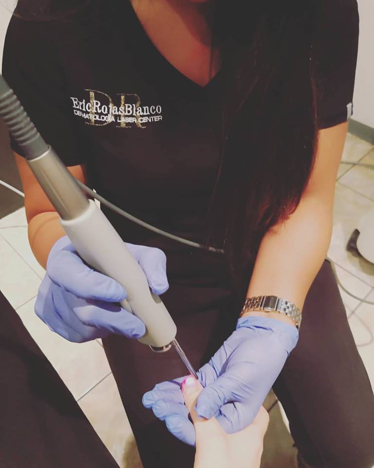 Elimine los hongos de las uñas con el @dr.ericrojas