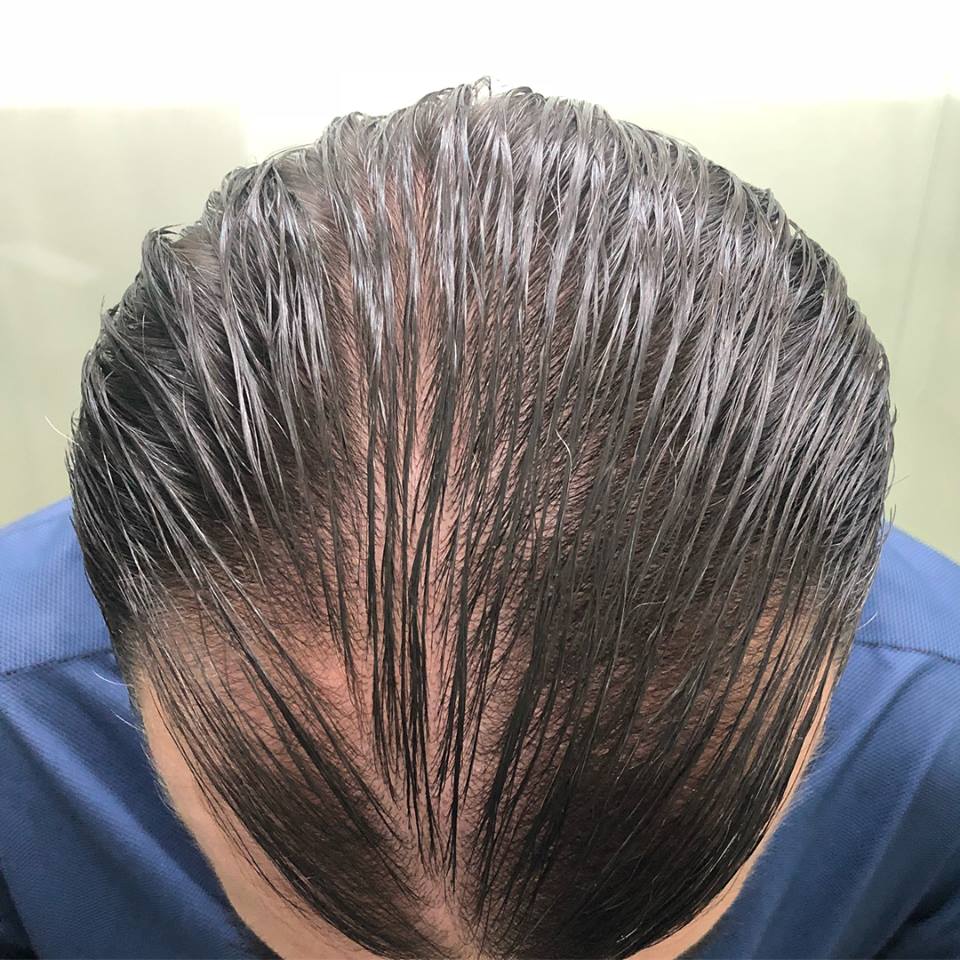 Cabello NO DEJE QUE SE PIERDA