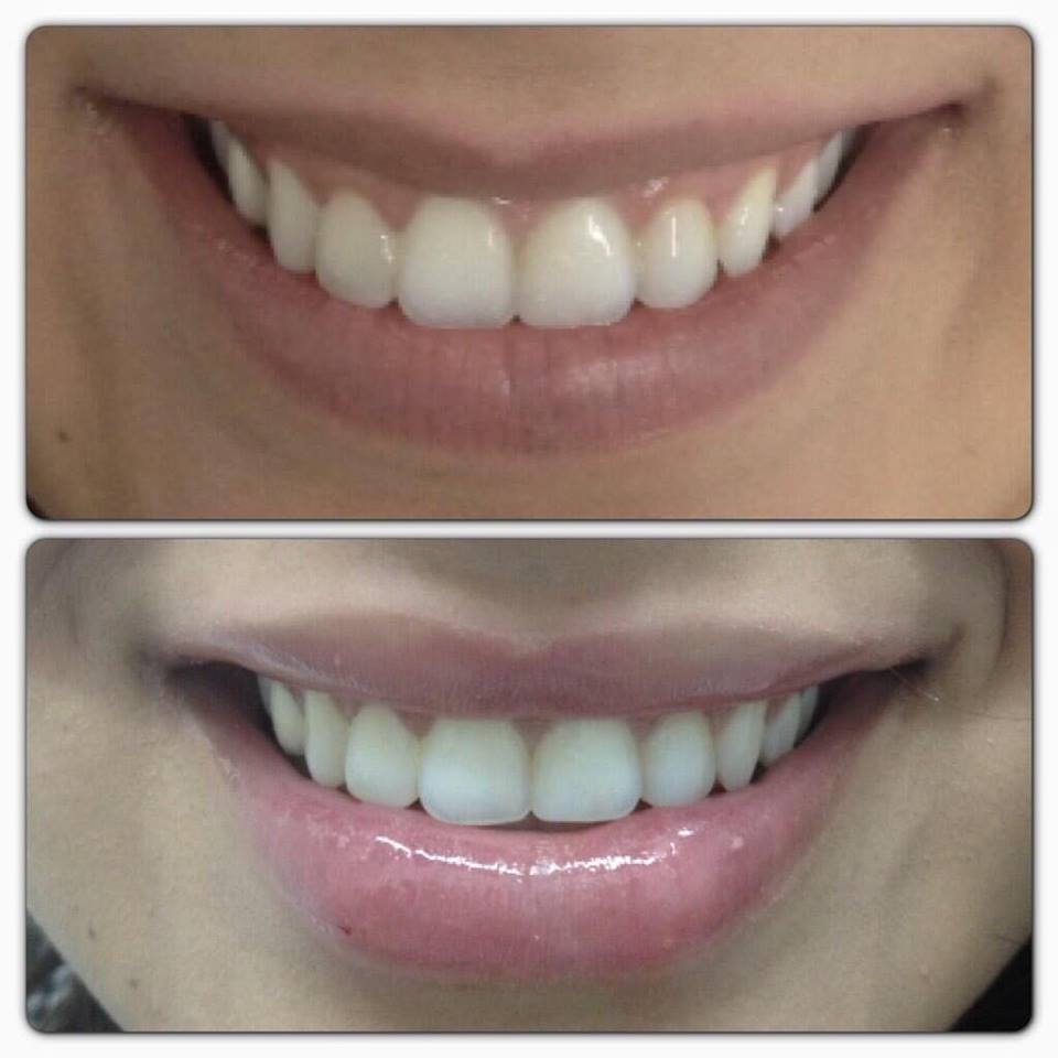 Quieres tener labios más atractivos