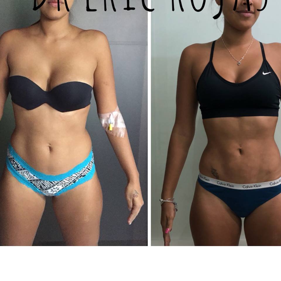 SLIM LÁSER CAMBIA TU CUERPO Y TU VIDA