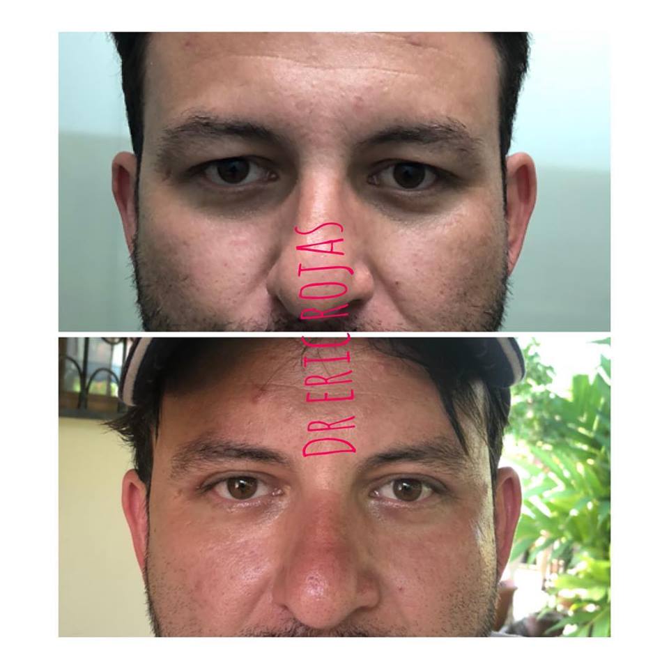 Refresca tu mirada