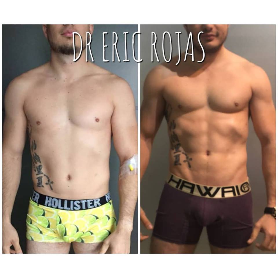 Una sesión el @dr.ericrojas logra estos resultados