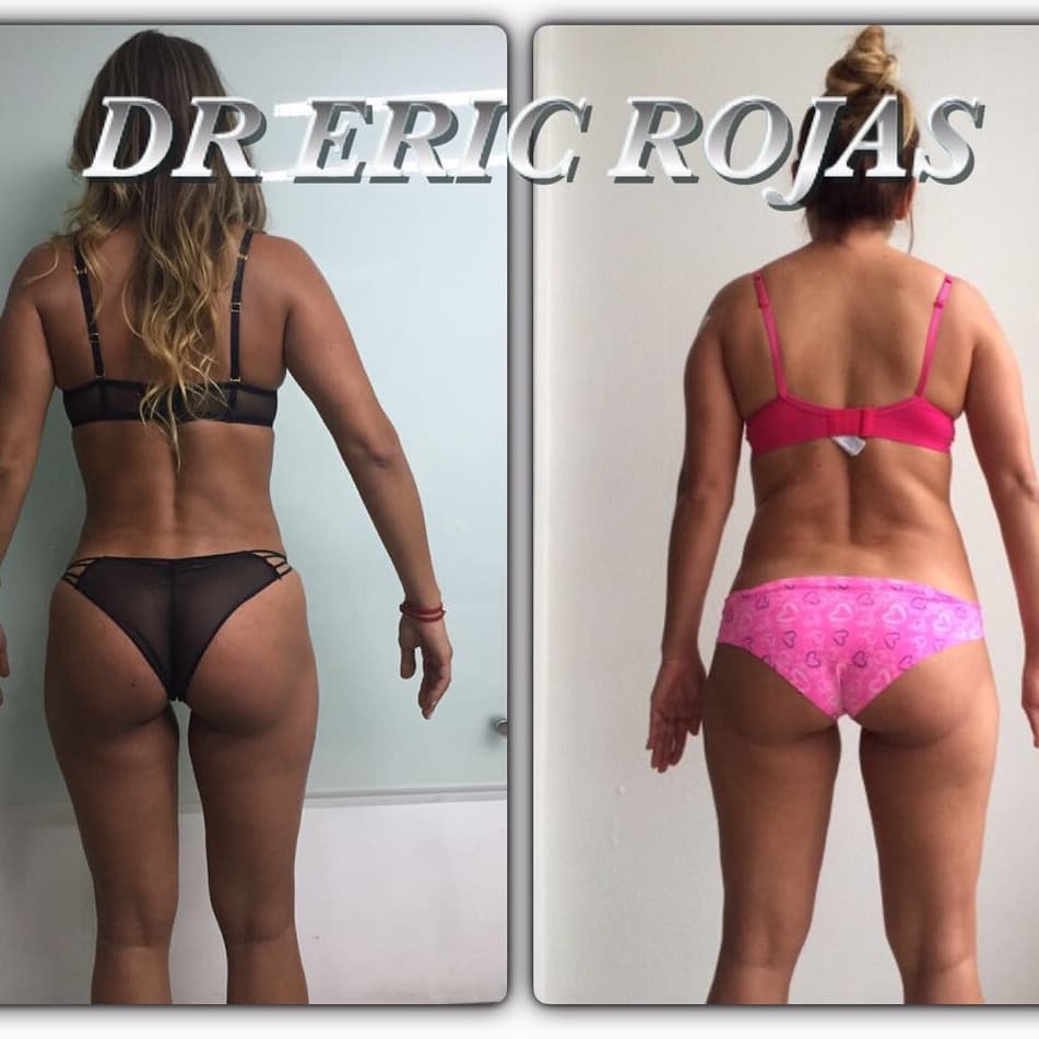 Logramos excelentes resultados