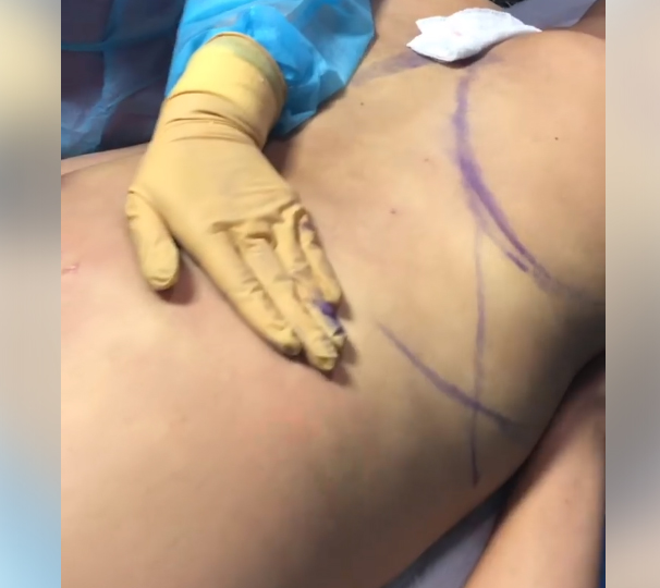 Slim Laser